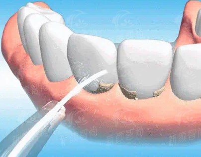 天津滨海看牙攻略！阳光树口腔门诊部特色项目解析，新颜智尚小程序预约挂号不踩坑