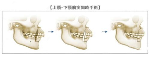 哈尔滨杨宇梓眼部修复价格贵吗？机构地址、乘车路线及口碑评价一览，24小时新颜智尚小程序预约