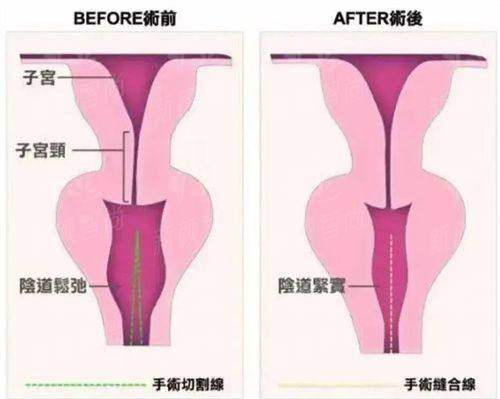 四、沈阳东北国内外医院整形美容医院:真实实例见证,容貌逆袭不是梦