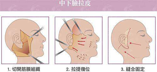 五、西安颜即医疗美容连锁(高新万达分院)：真实实例分享，见证素颜逆袭的高光时刻