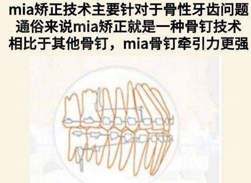 四、上海市东方医院整形外科皮肤管理：胡皓医生“三合一”战神，痘坑克星