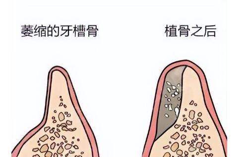 四、宁波颜蕾医美美肤抗衰(鄞州院区)特色项目：眼青春与分层吸脂的独门秘籍
