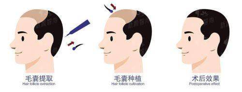 五、哈尔滨医 科 大附属第一医院整形外科：2026年收费价格表，明码标价透明公正