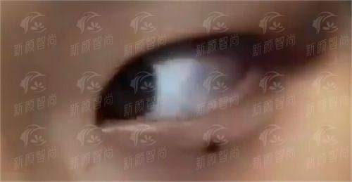 三、义乌星范医疗美容门诊部:眼鼻整形基地,拒绝“流水线”同款脸