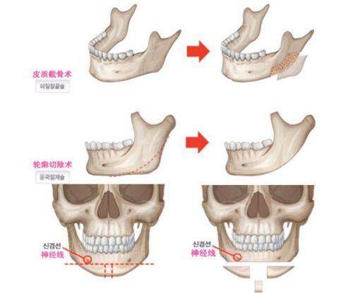 二、龙岩岩匠整形医院项目介绍：眼鼻胸皮肤一站式搞定