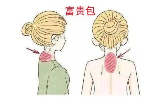 五、郴州臻妃植发医院真实实例:发友亲述,容貌逆袭不是梦