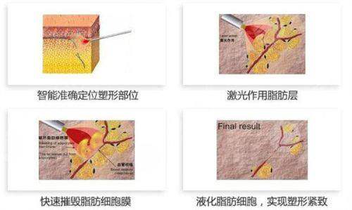 三、银川莲盛医疗美容诊所(碧莲盛植发):医生团队硬核实打,拒绝“影子医生”