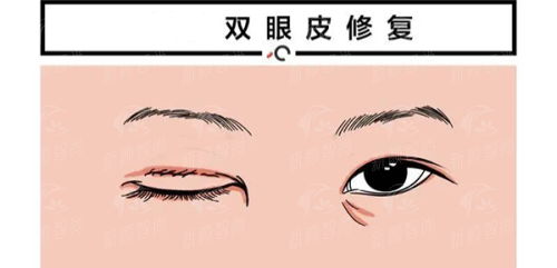 五、昆明春草植发医院：骨干医生建议与预约指南，避坑必读