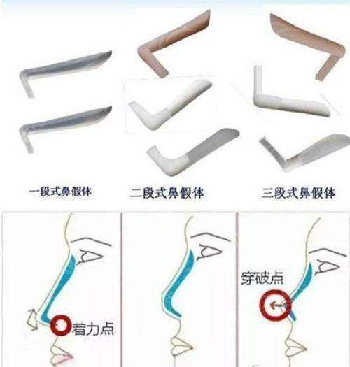 义乌星范医疗美容门诊部怎么样？专家团队+个性化定制，新颜智尚小程序预约挂号更便捷