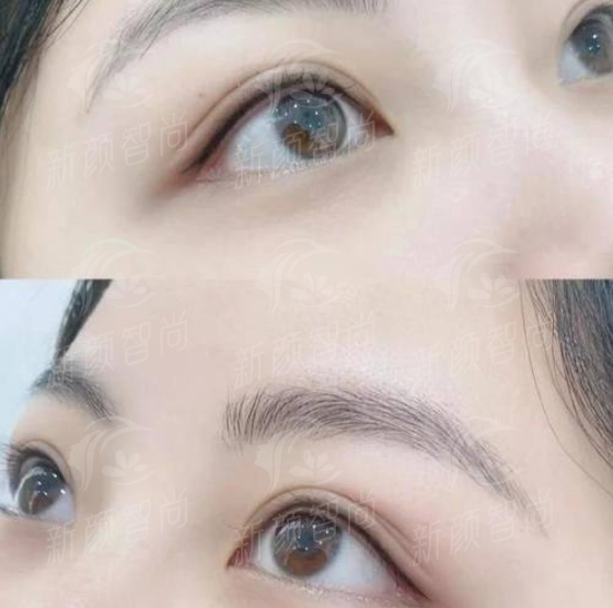 广东省人民医院（平洲分院）整形外科 - 五、2026年收费大公开，透明消费让你“心中有数”