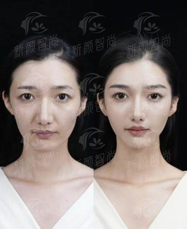 五、郑州京城皮肤美容医院:价格透明服务好,2026年全新收费参考