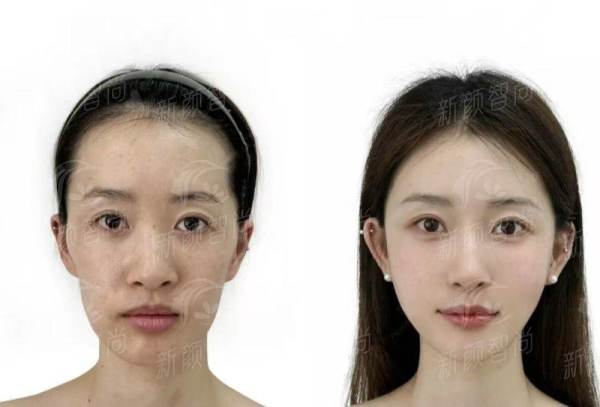 四、上虞艺美紫荆医疗美容(浙东总院) 2026年热门项目价格参考一览