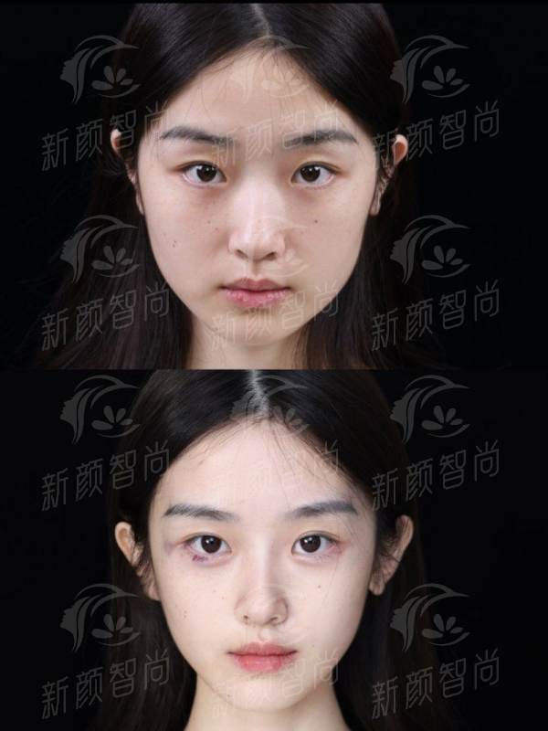 揭秘莆田卓睿医疗美容诊所价格表与案例，避坑指南+省钱攻略，新颜智尚小程序预约更省心
