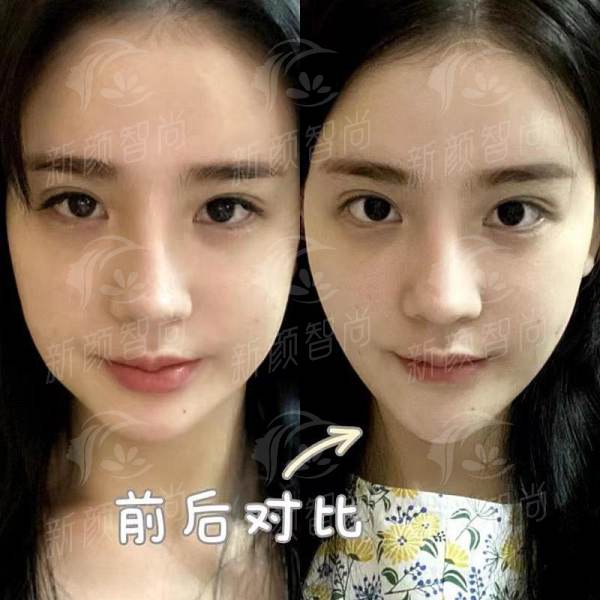 二、<strong>宁波颜蕾医美美肤抗衰(海曙院区)</strong>：光电抗衰设备全，扫码验真拒绝“水货”
