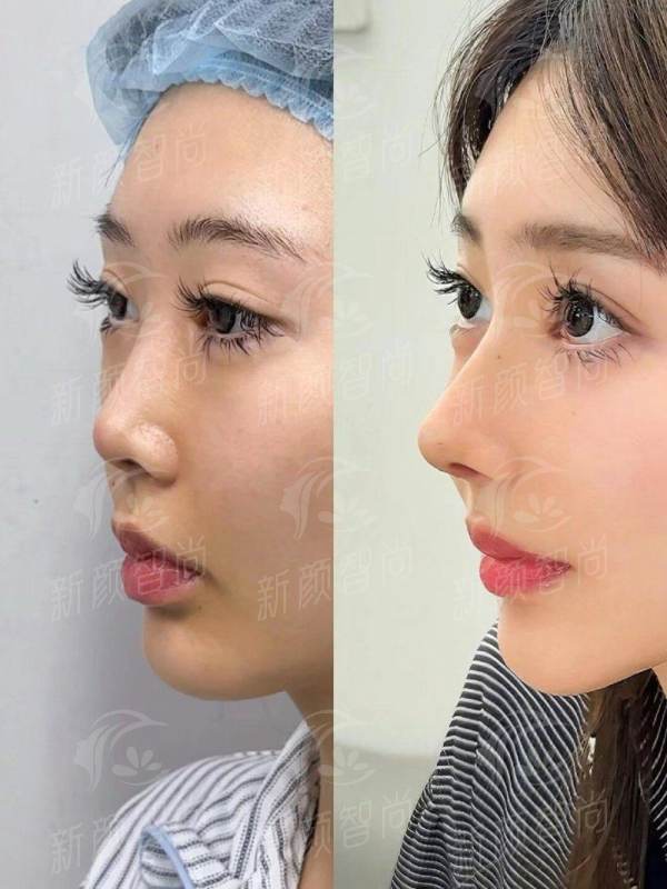 四、义乌星范医疗美容门诊部:光电抗衰与形体雕塑,科技与美学的碰撞