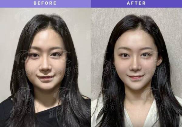 六、黄石德尔美克美亚医疗美容：避坑指南与预约挂号全攻略