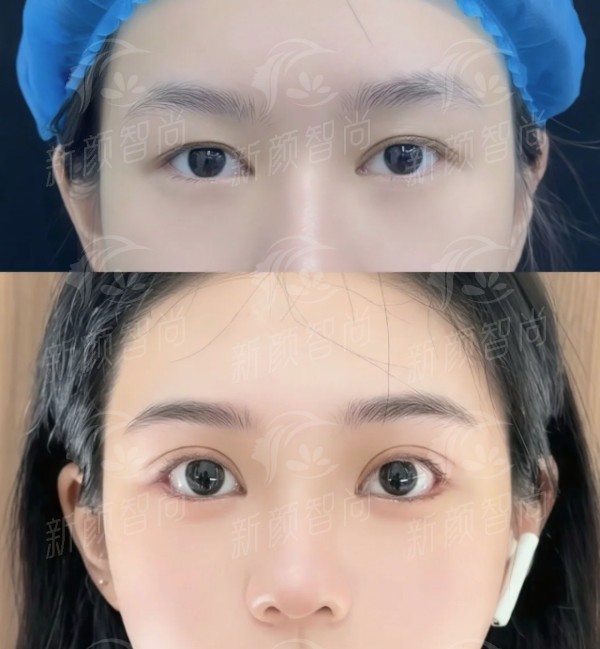 四、真实实例分享：在芜湖海螺医院-医美中 心重获自信的她们