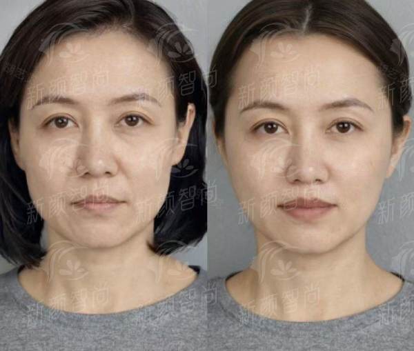 五、银川莲盛医疗美容诊所(碧莲盛植发):服务流程与环境,红旗文化大厦里的变得更美基地