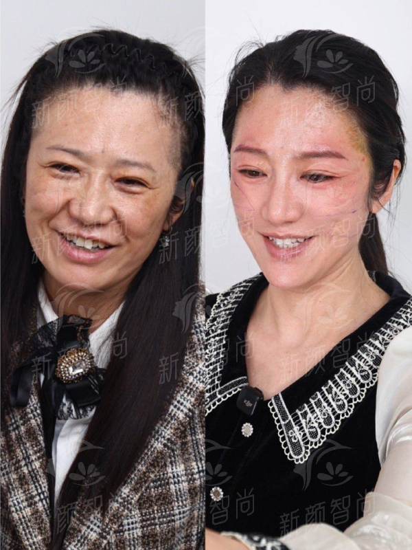 三、东莞市第六人民医院（东莞六院美容科门诊）：特殊自制药+光电中 心，皮肤管理“真香”警告