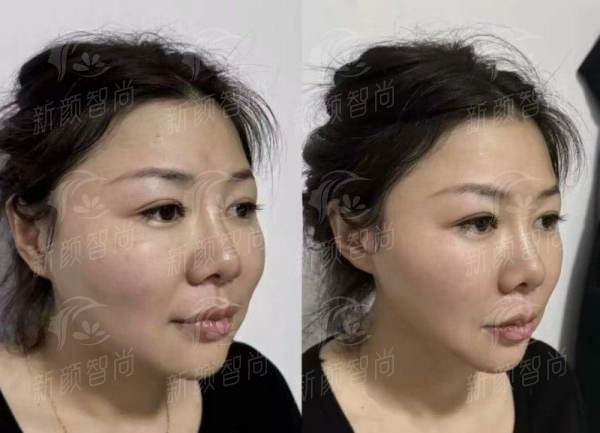 东莞六院美容科门诊怎么样？公立三甲医院专业医美，新颜智尚小程序预约挂号更便捷