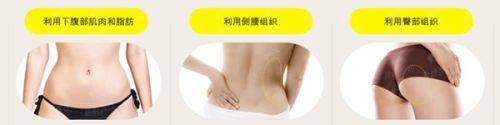 五、<strong style="color: red;">肇庆艾美医疗美容诊所（原圣蔻）</strong>：真实求美者实例分享与口碑评价