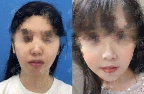 五、南昌优莱医疗美容门诊部顾客真实口碑与实例分享