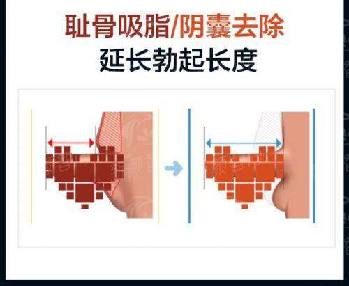 四、温州眼视光医院整形科2026年收费价格表：价格透明，拒绝隐形消费