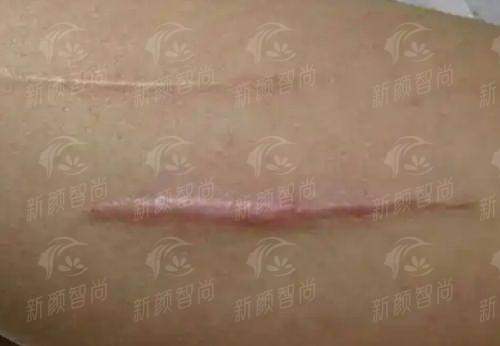 郑州诗璐医疗美容门诊部黄学峰富贵包连锁技术如何？听听老顾客怎么说，新颜智尚小程序预约挂号更便捷