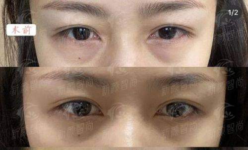六、<strong>三亚吉阳维多利亚医疗美容门诊所</strong>：真实实例分享，看看大家怎么说