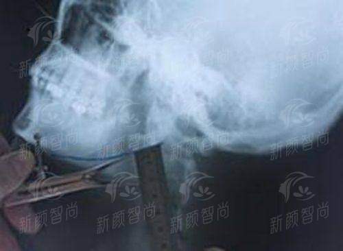 探访韩国Yezel伊泽尔皮肤科医院：5大抗衰技术解析，新颜智尚小程序线上预约挂号已开启