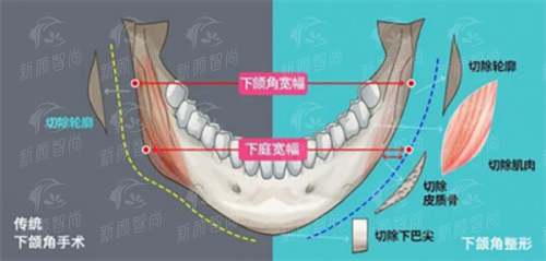 五、<strong style="color: red;">福鼎华美医疗美容医院</strong>：为什么要选择我们？优势大盘点