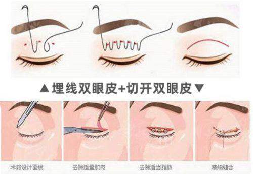 四、<strong style="color: red;">福鼎华美医疗美容医院</strong>：真实顾客实例分享，听听她们怎么说