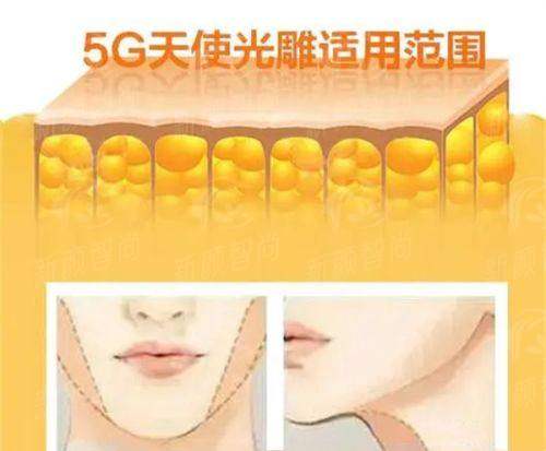 惠阳星途医疗美容诊所怎么样？探店必看项目盘点与医生团队介绍，新颜智尚小程序预约挂号更便捷