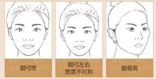 三、重庆碧莲盛植发(江北店)：CCTV上榜品牌，VIP服务让你躺着变帅