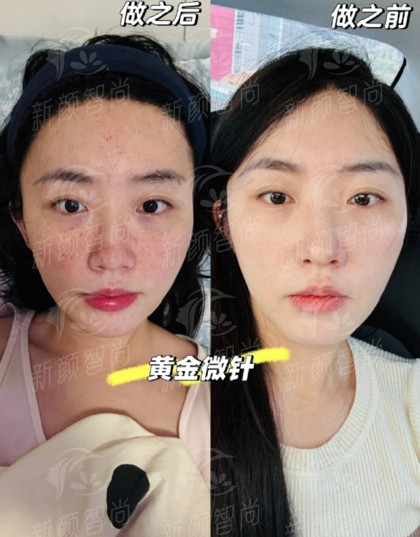 杭州艺星城西医疗美容门诊部靠谱吗？价格、医生、环境真实分享，新颜智尚小程序预约更省心