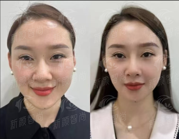 四、杭州艺星城西医疗美容门诊部:口碑实例分享,变得更美其实特别简单