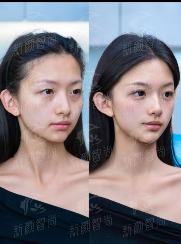 五、合肥碧莲盛医疗美容诊所——真实实例见证发友逆袭之路