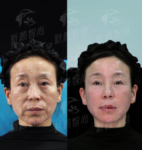 六、温州眼视光医院整形科就诊攻略：地址、挂号与贴心服务