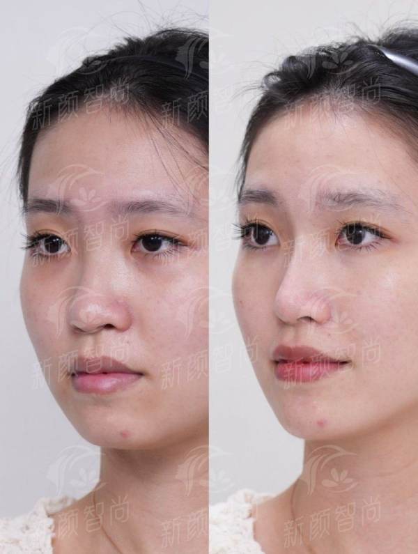 揭秘徐州臻颜汐禾医疗美容门诊部！口碑探店+真实案例分享，附新颜智尚小程序预约方式