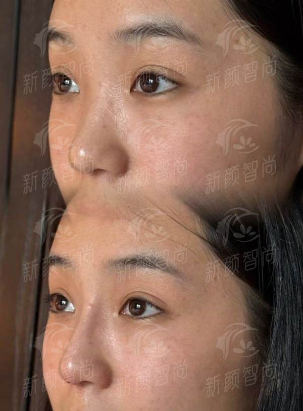成都熙朵植发医院怎么样？技术优势和价格全解析，新颜智尚小程序预约挂号更便捷