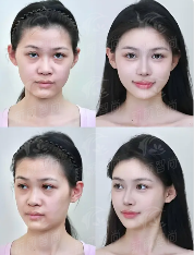 六、承德欧亚圣医疗美容医院：真实口碑与实例分享，交通便利预约指南