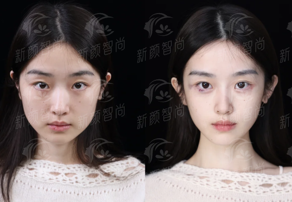 五、徐州臻颜汐禾医疗美容门诊部如何避坑与选择指南