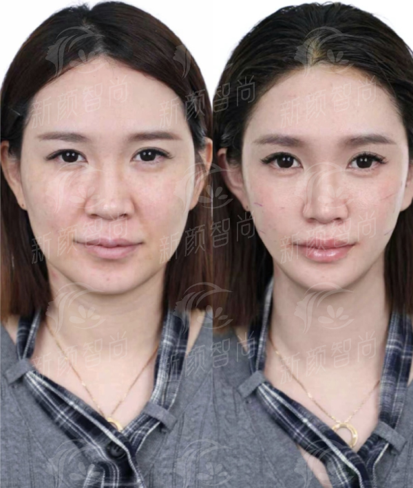 三、重庆郑荃丽格医疗美容诊所(涪陵院区):以色列飞顿硬核设备,皮肤管理焕新颜