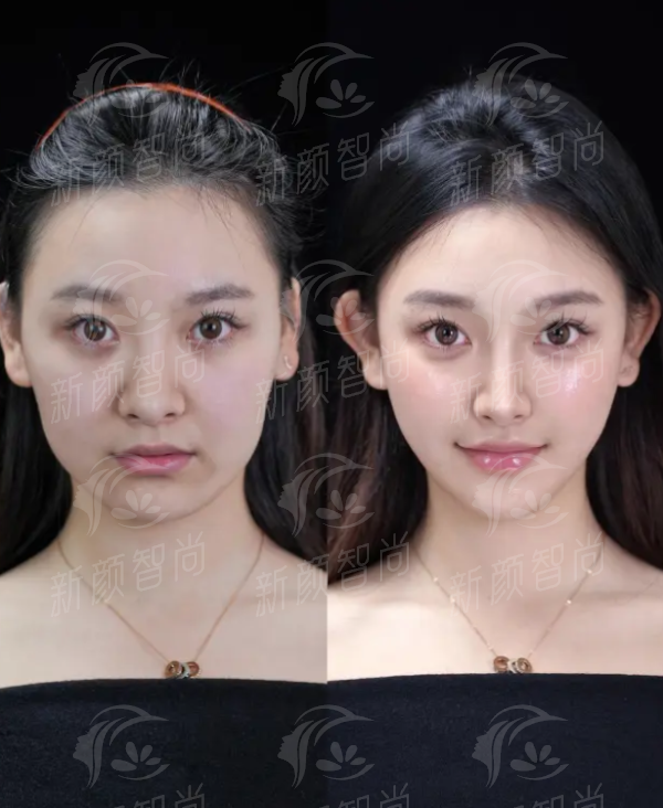 六、<strong style="color: red;">肇庆艾美医疗美容诊所（原圣蔻）</strong>：预约挂号流程与温馨提示