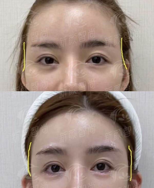 亳州缔莱美整形医院——三、2026年价格表大公开，让你美得明明白白！