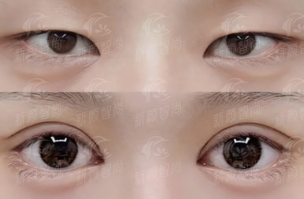 想变美怕踩坑？肇庆艾美（原圣蔻）医生团队与设备大公开，新颜智尚小程序预约更省心