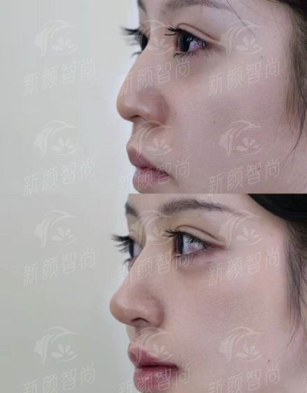 合肥碧莲盛靠谱吗？资深美学顾问亲授避坑指南，上新颜智尚小程序挂号不踩坑