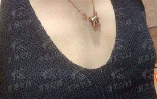 五、辽阳鞍山燕丽医疗美容诊所：真实实例分享，从路人甲到魅力女神的蜕变