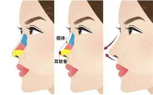 三、杭州大麦整形外科门诊部（大麦微针植发）：院长级骨干医生天团，为成效保驾护航