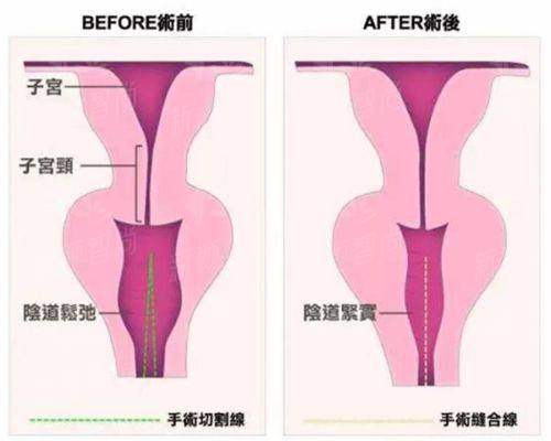 四、长沙玺罗医疗美容诊所（国金院区）——顾客真实口碑见证，满意实例分享